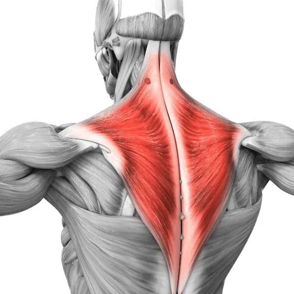 Trapezius Pain